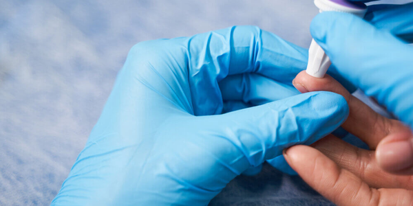 Общий анализ крови