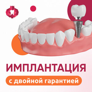 Имплант Osstem + коронка. Получите готовый зуб!