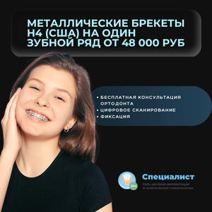 Металлические брекеты на 1 зубной ряд от 48 000 рублей