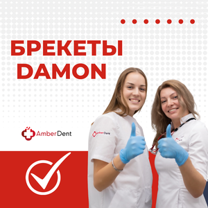 Установка брекетов 
