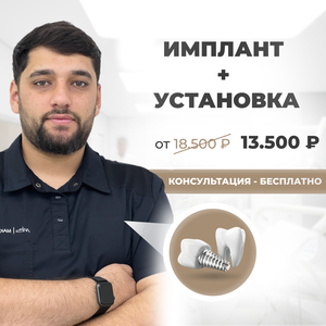 Имплантация зубов в Уфе. Осмотр врача - бесплатно!
