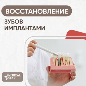 Единичная имплантация