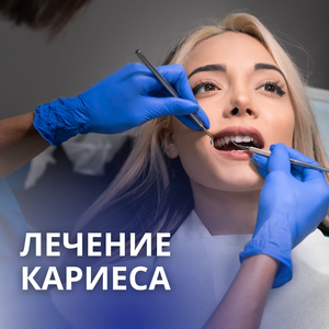 Лечение кариеса по технологии ICON