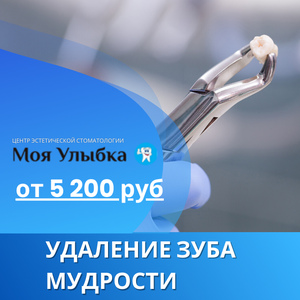 Удаление зуба мудрости