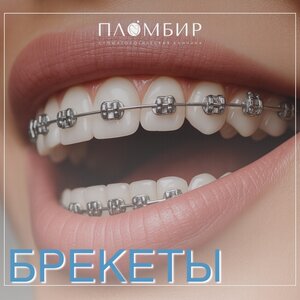 Брекеты от 