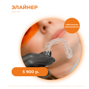 Элайнер (каппа)