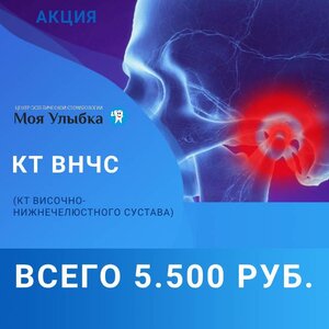КТ ВНЧС (КТ височно-нижнечелюстного сустава) 