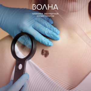 Удаление новообразований