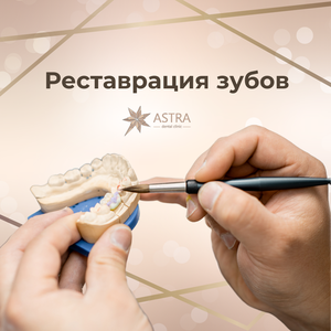 Прямая композитная реставрация зуба