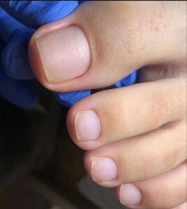Педикюр без покрытия