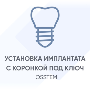Установка имплантата Osstem с коронкой под ключ