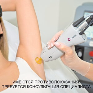 Лазерная эпиляция: подмышки в Авторской клинике