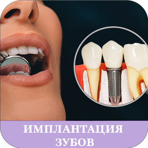 Имплантация зубов