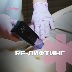 RF-лифтинг