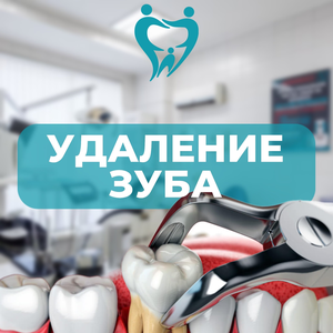 Удаление зуба от