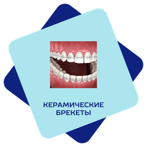 Керамические брекеты 