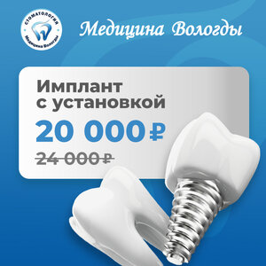Имплант с установкой. 