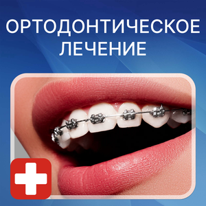 Брекеты и элайнеры