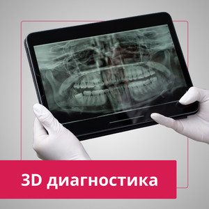 3D диагностика
