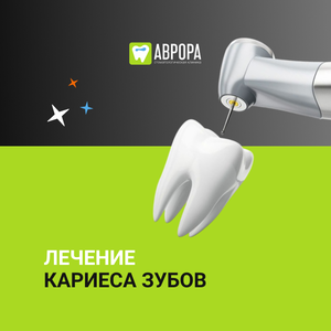 Лечение кариеса зубов