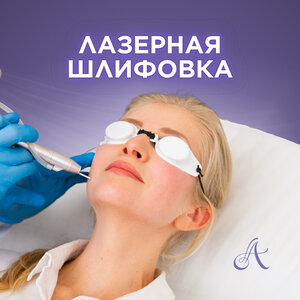 Лазерная шлифовка 