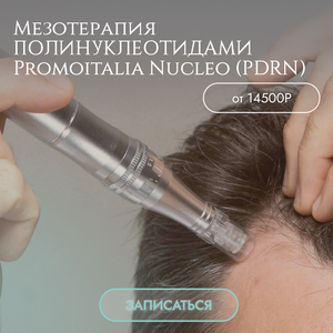 Мезотерапия полинуклеотидами Promoitalia Nucleo (PDRN)