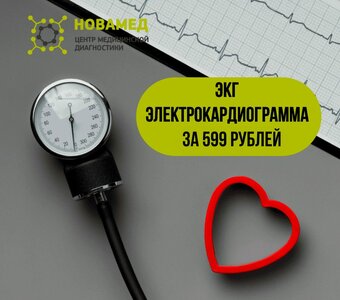 ЭКГ (электрокардиограмма)