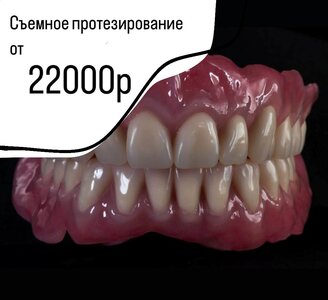 Съемное протезирование