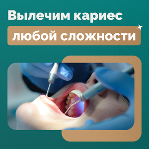 Лечение кариеса