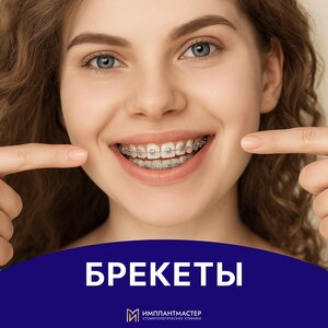 Брекеты от