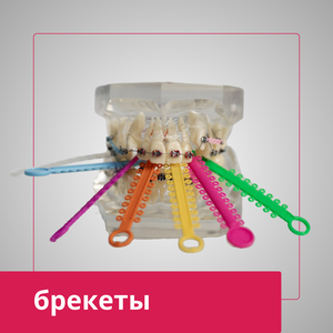 Исправление прикуса