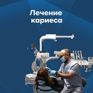 Лечение кариеса