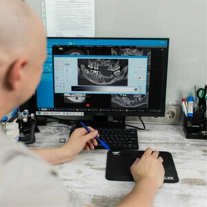 Внутрикосная дентальная имплантация snucon - Южная Корея