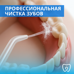 Профессиональная чистка зубов от
