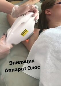 Элос (эпиляция волос)