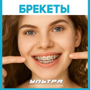 Брекеты от