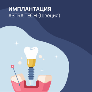 Имплантация Astra Tech (Швеция)