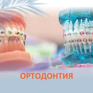 Установка брекетов