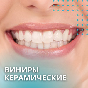 Керамические виниры - "Голливудская улыбка"