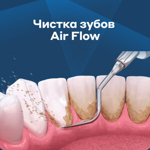 Чистка зубов Air Flow