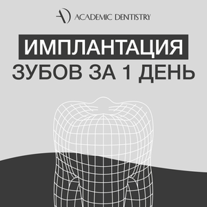 Имплантация зубов за 1 день
