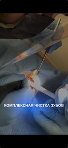 Гигиена полости рта (трёхэтапная)