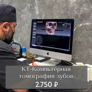КТ-Компьютерная томография (3D снимок зубов) 