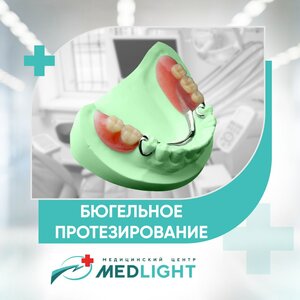 Бюгельное протезирование