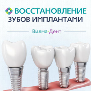 Имплантация
