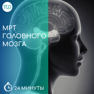 МРТ головного мозга