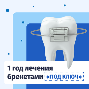 Исправление прикуса брекетами