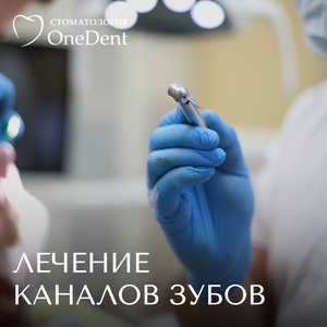 Комплексное лечение пульпита, 1-канальный зуб