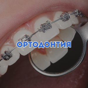 Ортодонтия