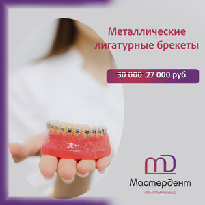 Ортодонтия/брекеты/капы